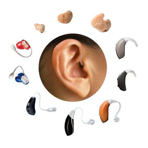 5 Things to consider before buying any hearing aid